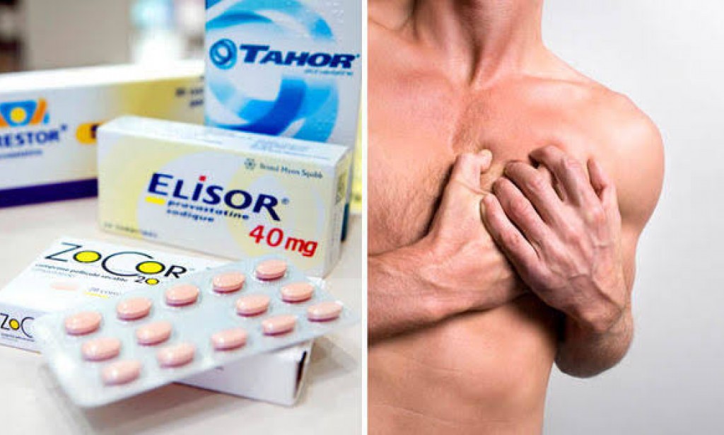 Heart Attack And Medication