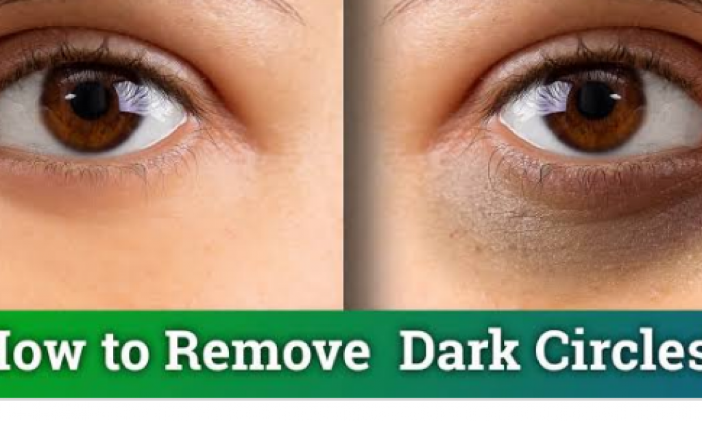 Milk can remove dark circles