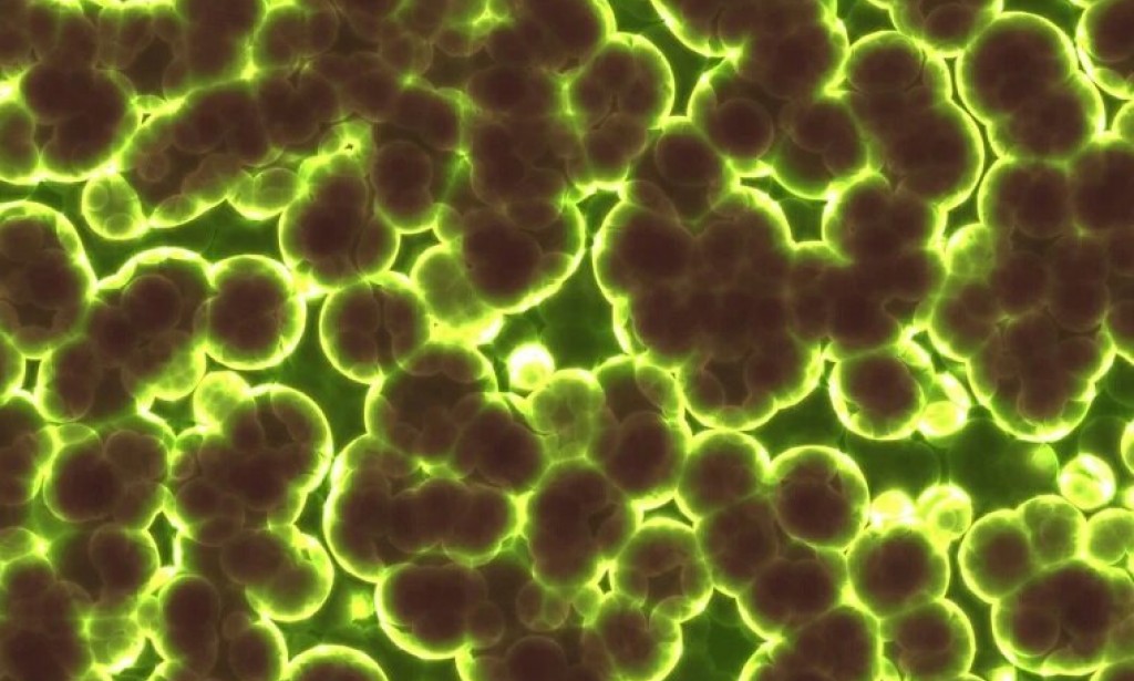 Top 10 interesting facts about the plague