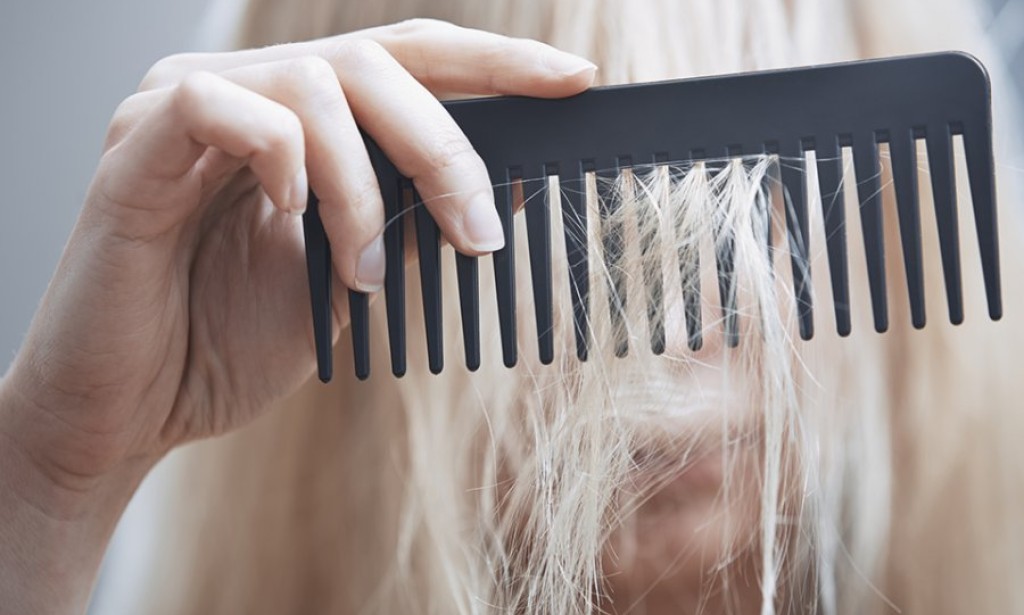The main causes of hair loss have been named
