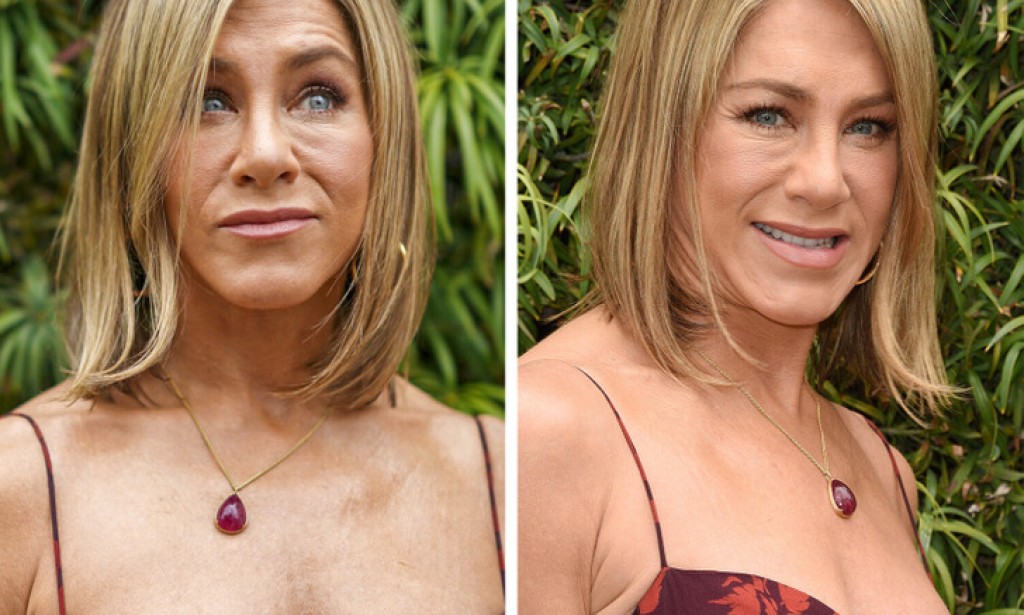 Celebrities Who Spent A Fortune Changing Their Looks